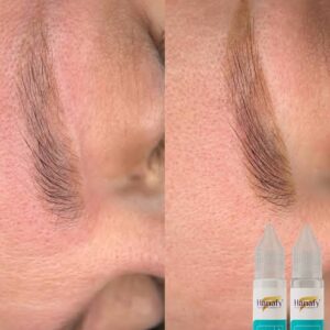 ONLINE EDUKACIJA – HANAFY REMOVER TRETMAN