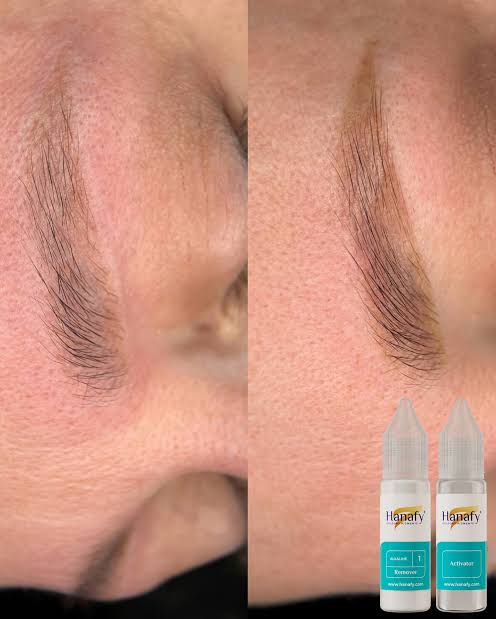 ONLINE EDUKACIJA – HANAFY REMOVER TRETMAN